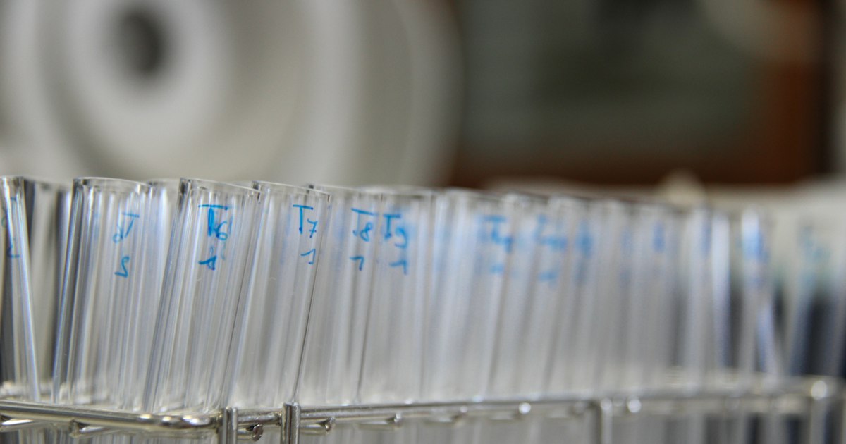 UDCA vs Silymarin: what is the difference