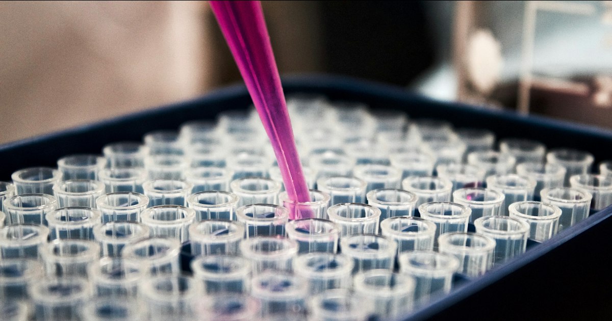 NAC vs Silymarin: what to choose and for whom